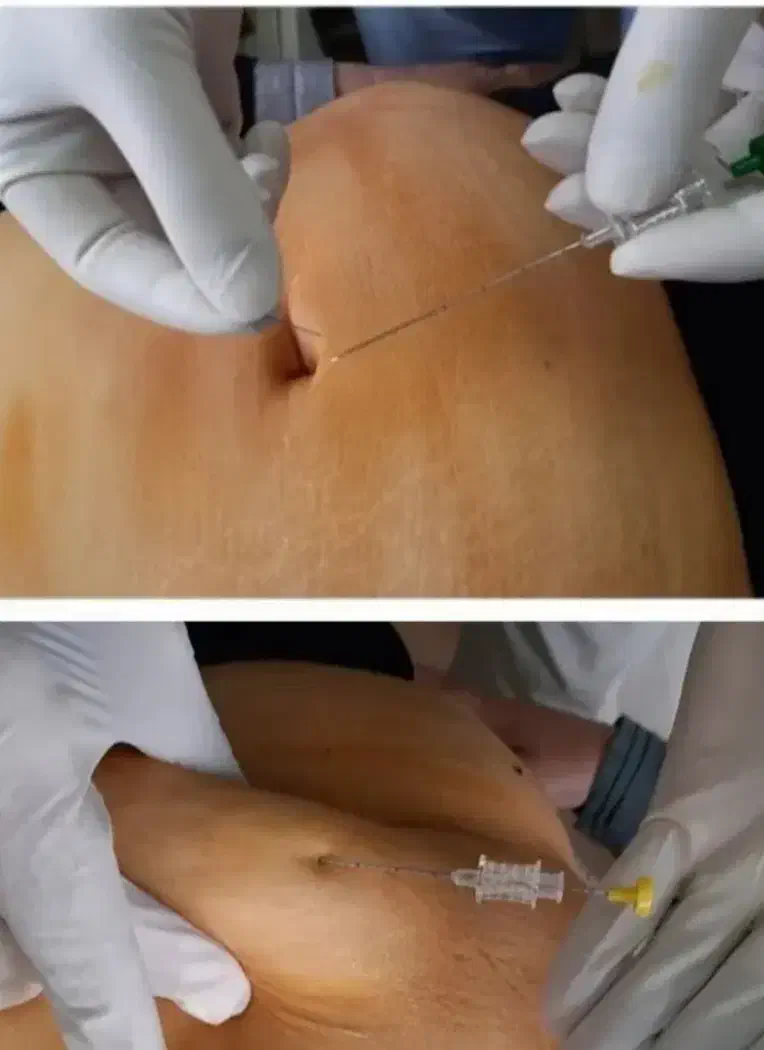 لاغری فقط بایک جلسه|خدمات آرایشگری و زیبایی|تبریز, |دیوار