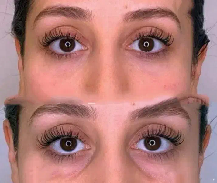 جشنواره ژل لب فیلر زیرچشم،شقیقه،بوتاکس،کلینیک پزشک|خدمات آرایشگری و زیبایی|کرج, گوهردشت|دیوار