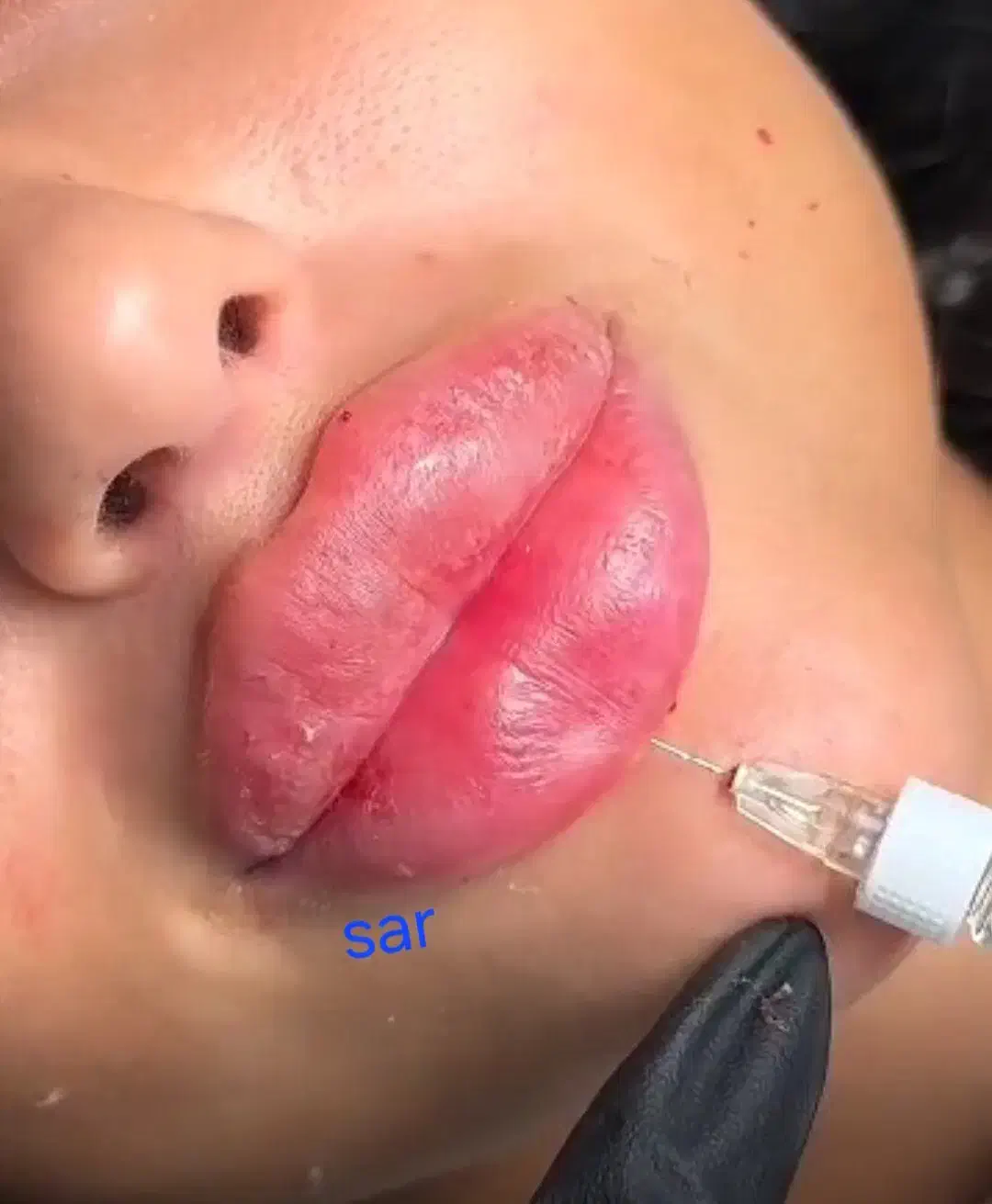 تزریق وآموزش ژل وبوتاکس  ۲۵۰۰ درکلینیک|خدمات آرایشگری و زیبایی|اهواز, بیست متری شهدا|دیوار