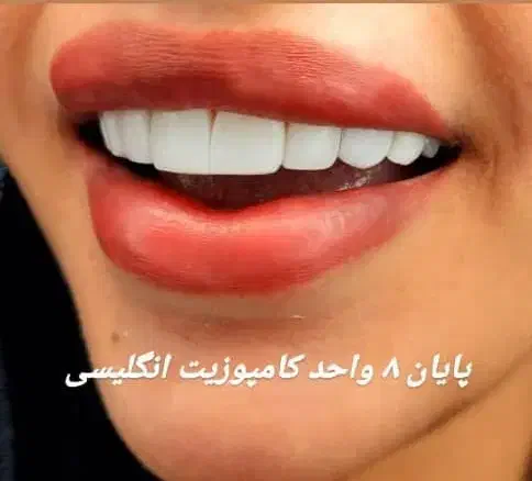 تخفیف خدمات کامپوزیت|خدمات آرایشگری و زیبایی|اهواز, زیتون کارمندی|دیوار