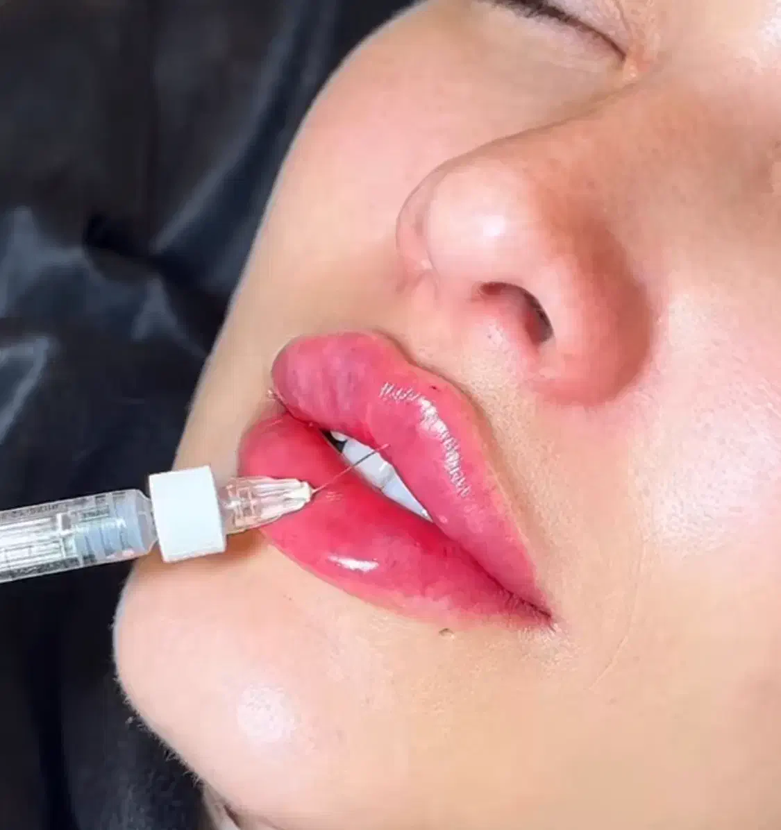 ژل و بوتاکس|خدمات آرایشگری و زیبایی|سبزوار, هویزه|دیوار