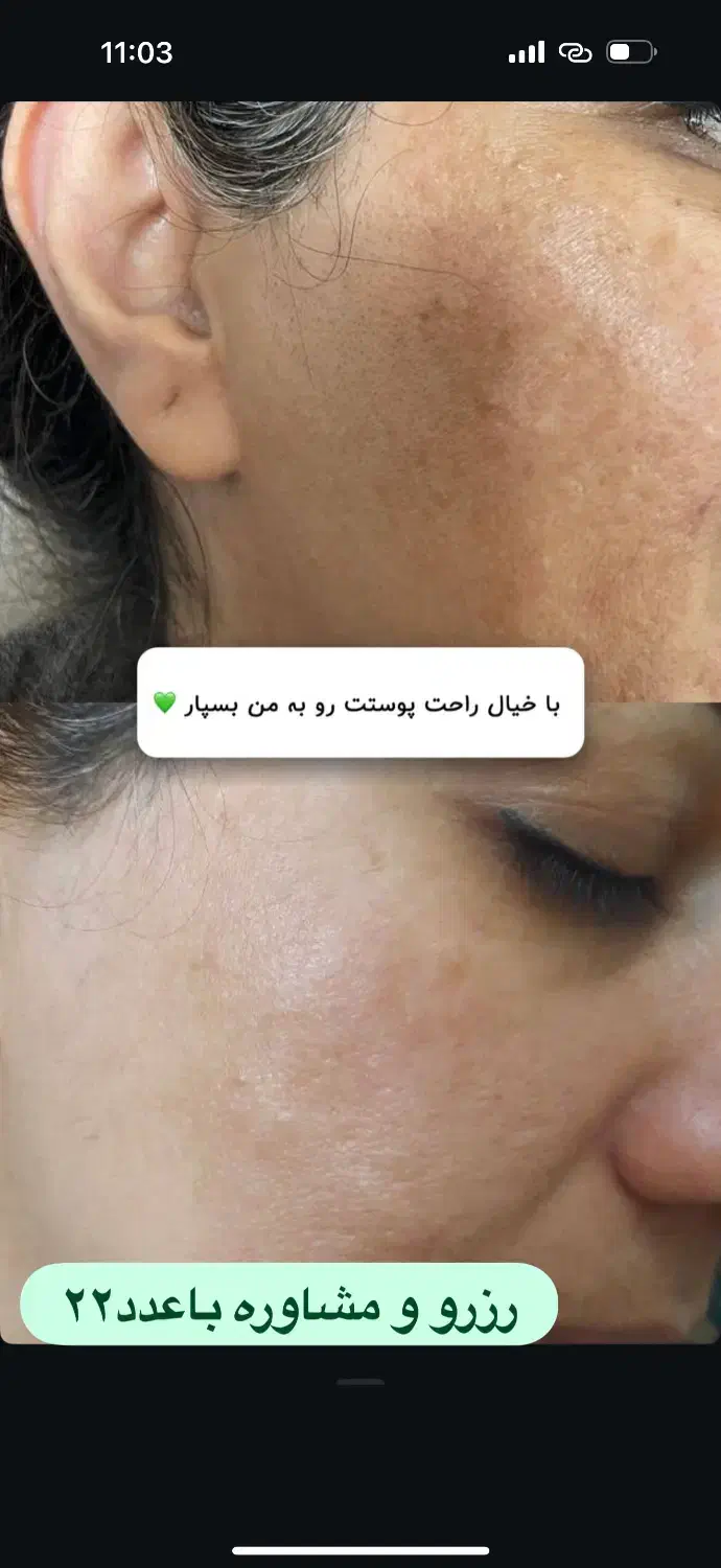 ریمولک تک جلسه ایی|خدمات آرایشگری و زیبایی|سرپل ذهاب, |دیوار