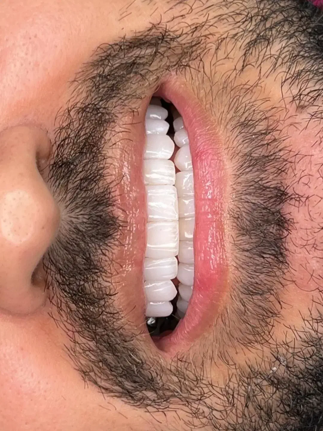 کلینیک تخصصی دندانپزشکی زیبایی|خدمات آرایشگری و زیبایی|شهریار, شهریار|دیوار