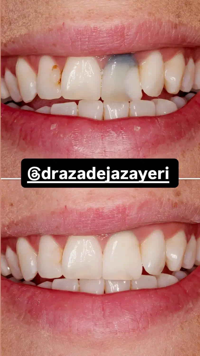 تخفیف خدمات دندانپزشکی|خدمات آرایشگری و زیبایی|رشت, گلسار|دیوار