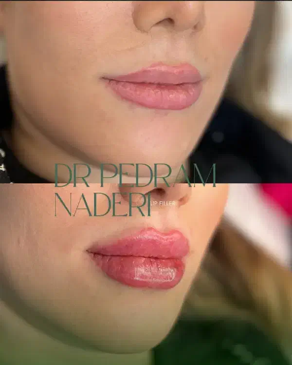 کیلینیک زیبایی (پوست ،مو ،لیزر )|خدمات آرایشگری و زیبایی|اسلام‌شهر, شهرک واوان|دیوار