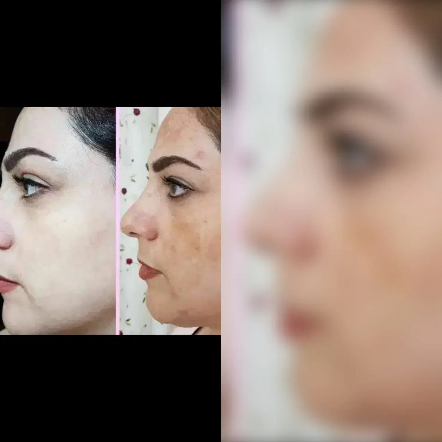 کرم تضمینی صورت معجزه|آرایشی، بهداشتی، درمانی|خاش, |دیوار