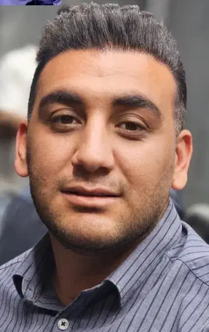 کاشت مو کوهدشت|خدمات آرایشگری و زیبایی|کوهدشت, |دیوار