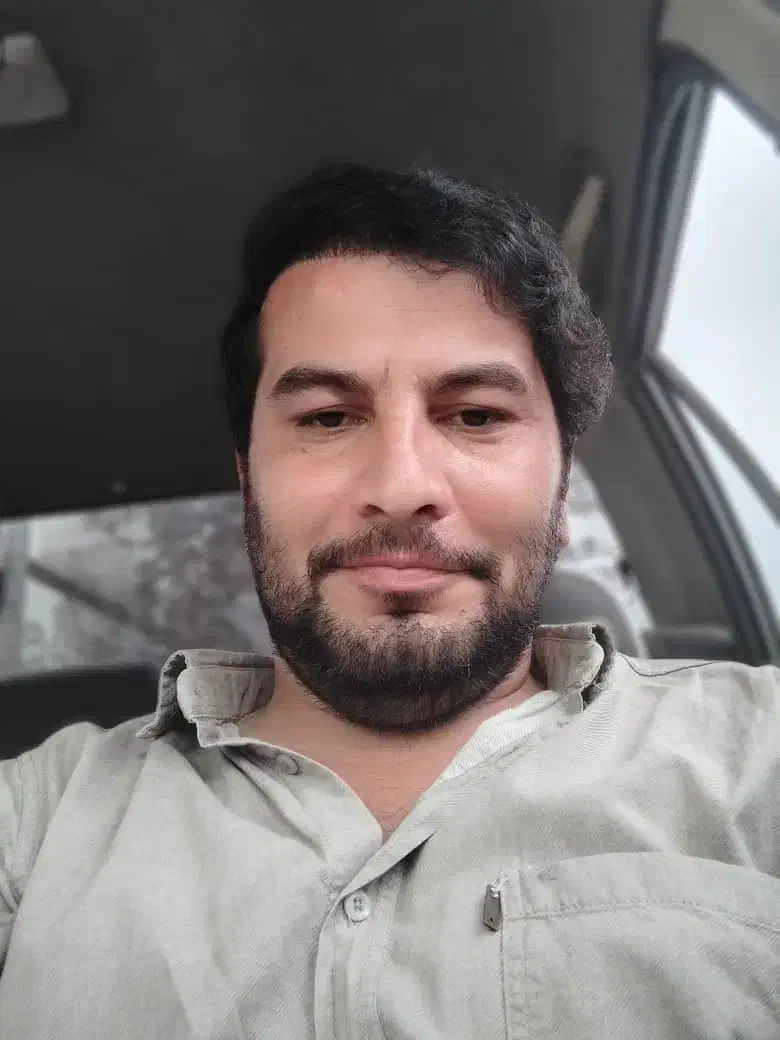 کاشت مو و ابرو با جدیدترین متدهای روز|خدمات آرایشگری و زیبایی|تبریز, |دیوار