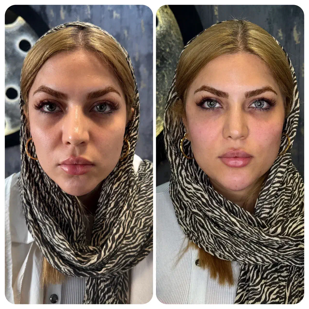 جشنواره لیفت تخصصی صورت با نخ و کانتورینگ|خدمات آرایشگری و زیبایی|بروجرد, |دیوار