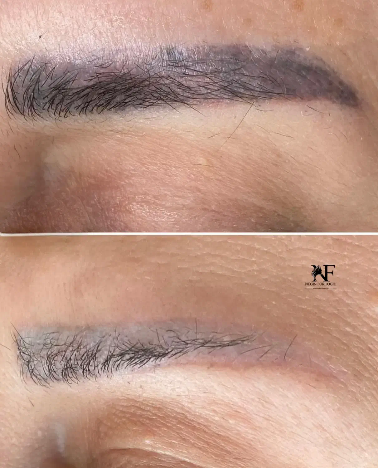 ریموو تک‌جلسه ای با رجووی اصل ومیکروبلیدینگ شیدینگ|خدمات آرایشگری و زیبایی|رشت, لاکانی|دیوار