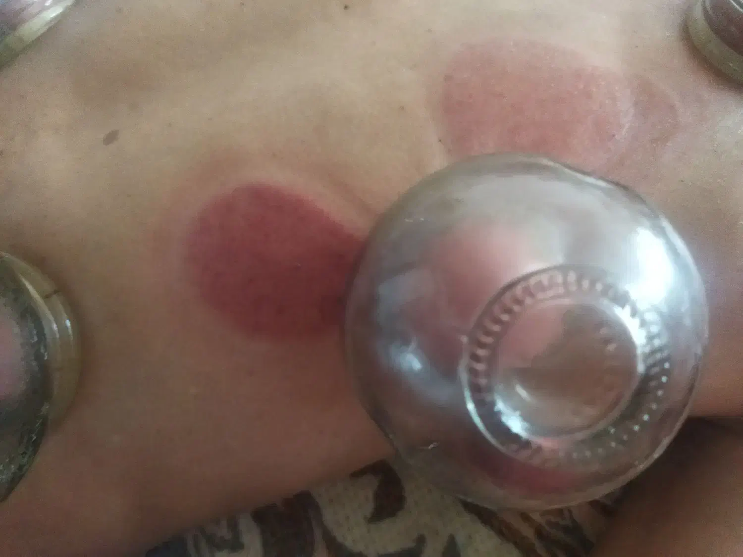 حجامت و بادکشی در منزل|خدمات آرایشگری و زیبایی|بیرجند, |دیوار