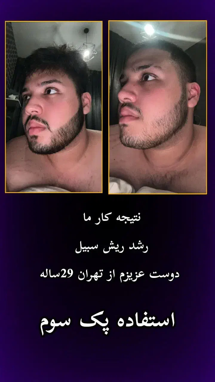 مشاوره تخصصی پوست و مو|آرایشی، بهداشتی، درمانی|تهران, دهم فروردین|دیوار