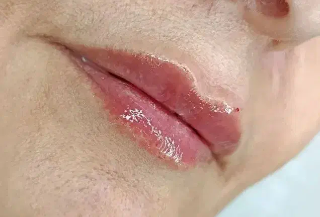 خدمات ژل فقط ۵۸۰ وبوتاکس ۷۵۰ در مطب|خدمات آرایشگری و زیبایی|نجف‌آباد, حومه نجف آباد|دیوار