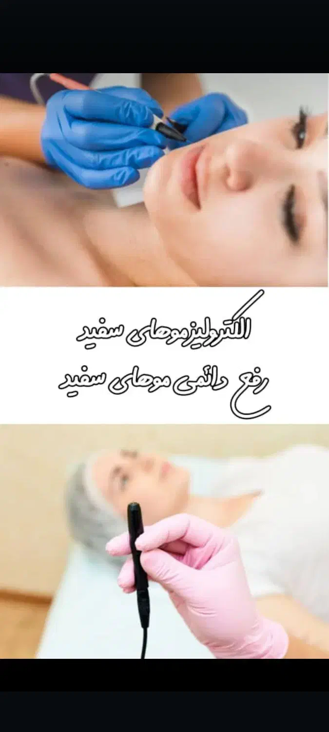 لیزر موهای زائد/مشکی/سفید/خالبرداری/جوانسازی|خدمات آرایشگری و زیبایی|شاهین‌شهر, فردوسی|دیوار