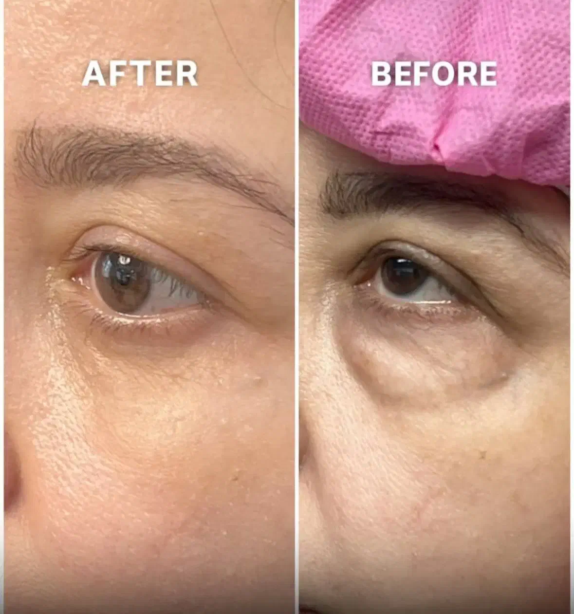 بلفارو پلاستی|خدمات آرایشگری و زیبایی|ری, علایین|دیوار