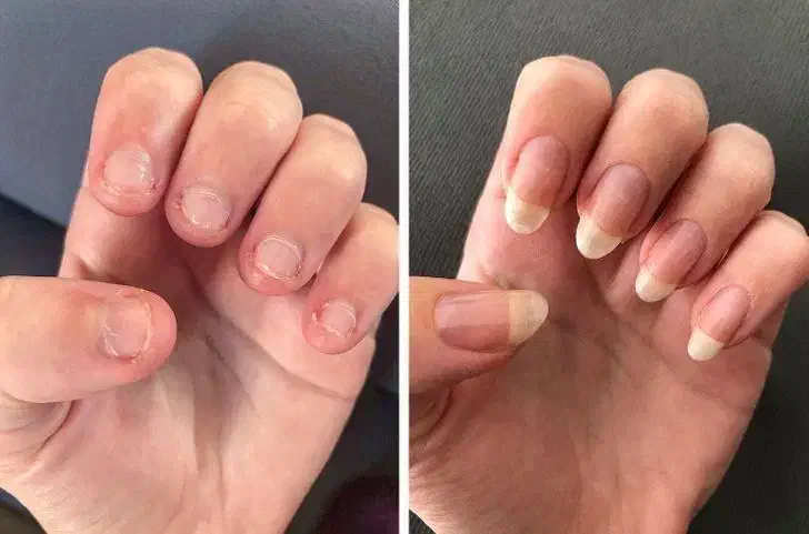 تقویت ناخن|آرایشگاه و سالن‌های زیبایی|مشگین شهر, |دیوار