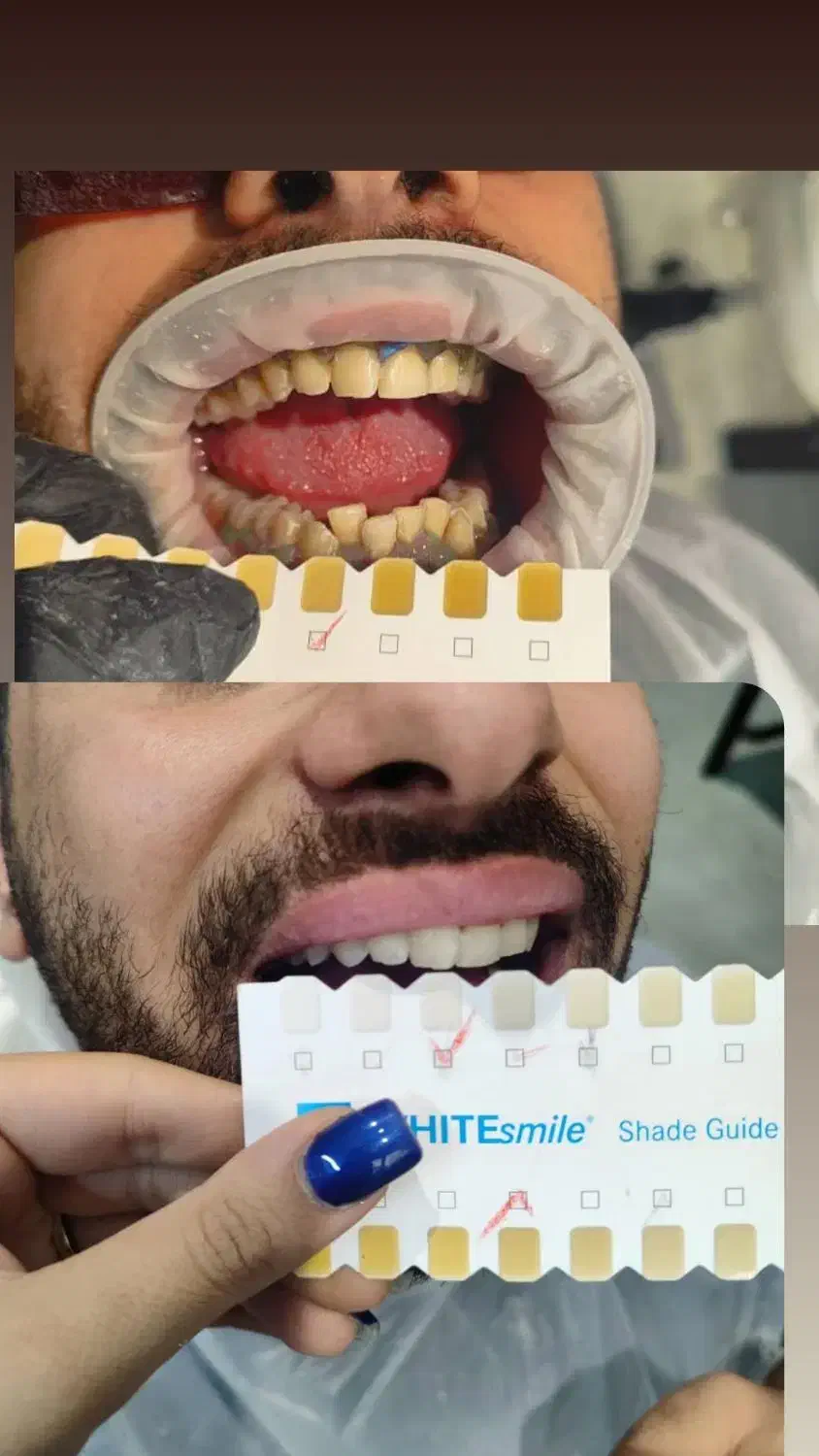 آموزش تخصصی دندانسازی و بلیچینگ و کامپوزیت|خدمات آموزشی|شیراز, معالیآباد|دیوار