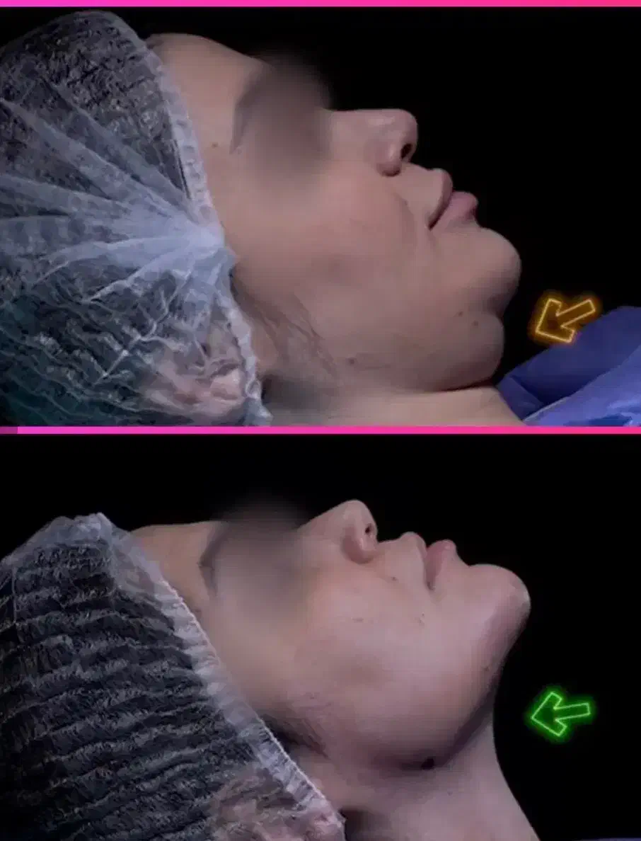 خدمات تزریق چربی ، ژل، بوتاکس، فیلر بادی|خدمات آرایشگری و زیبایی|قم, پردیسان|دیوار