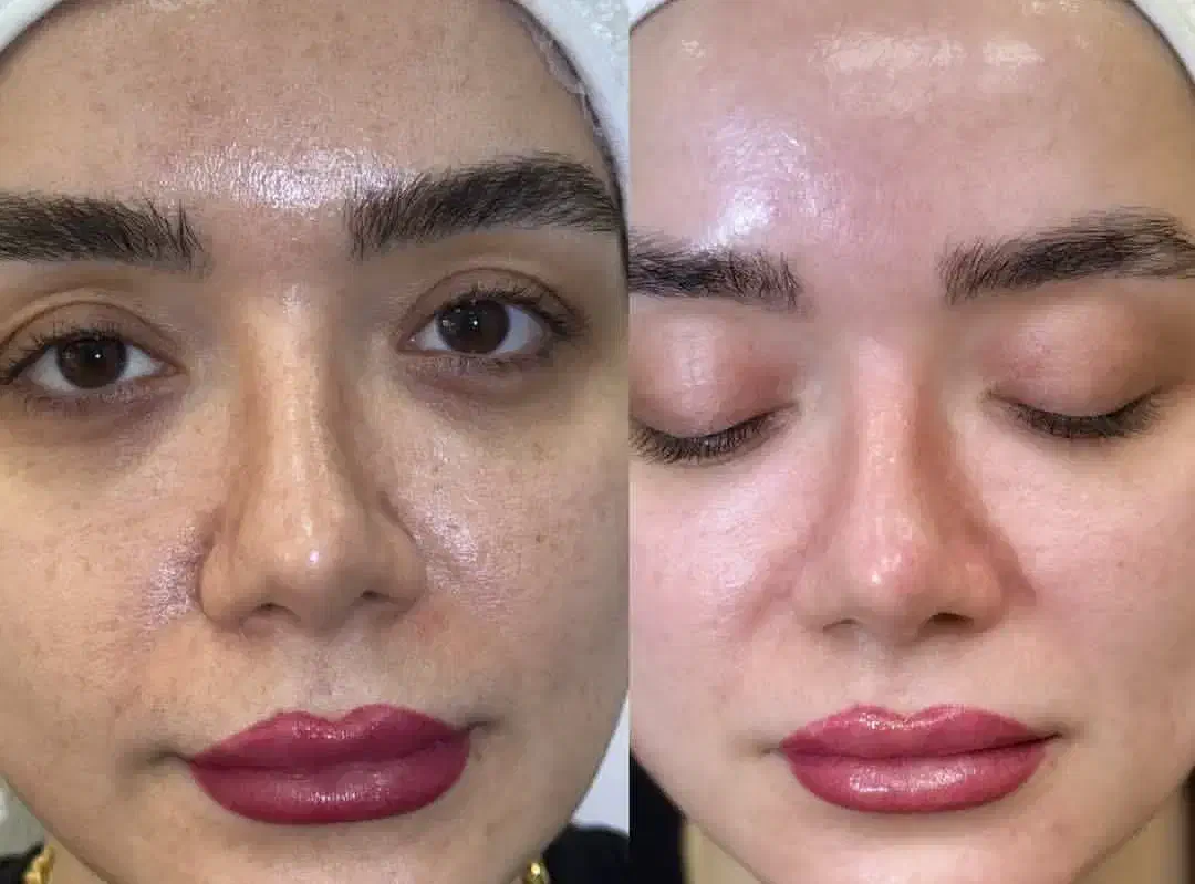 جذب نیروی خانم آنلاین باگوشی|استخدام بازاریابی و فروش|کازرون, |دیوار