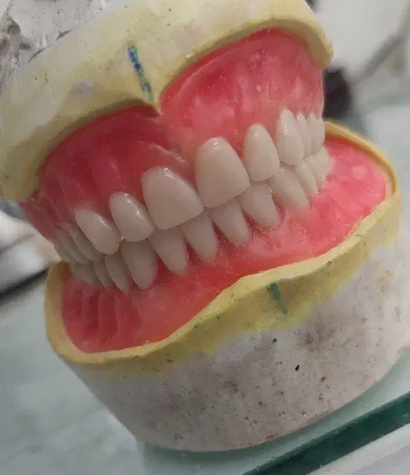 ( دندان سازی لبخند )|خدمات آرایشگری و زیبایی|زنجان, |دیوار