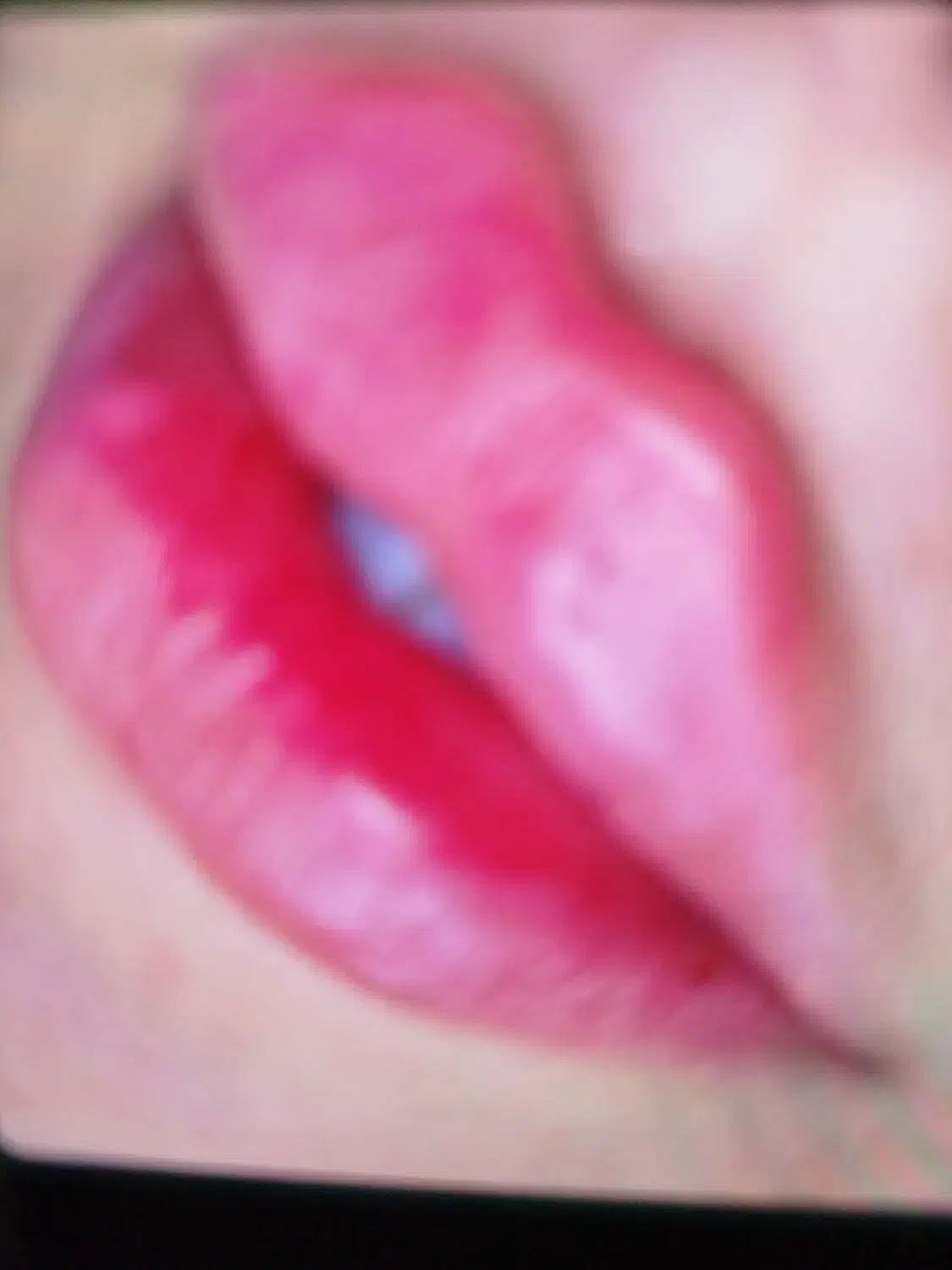 ژل لب بوتاکس|خدمات آرایشگری و زیبایی|نیشابور, ناسیونال|دیوار