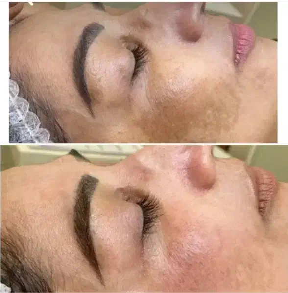 مزو ندلینگ|خدمات آرایشگری و زیبایی|مشهد, دانشجو|دیوار