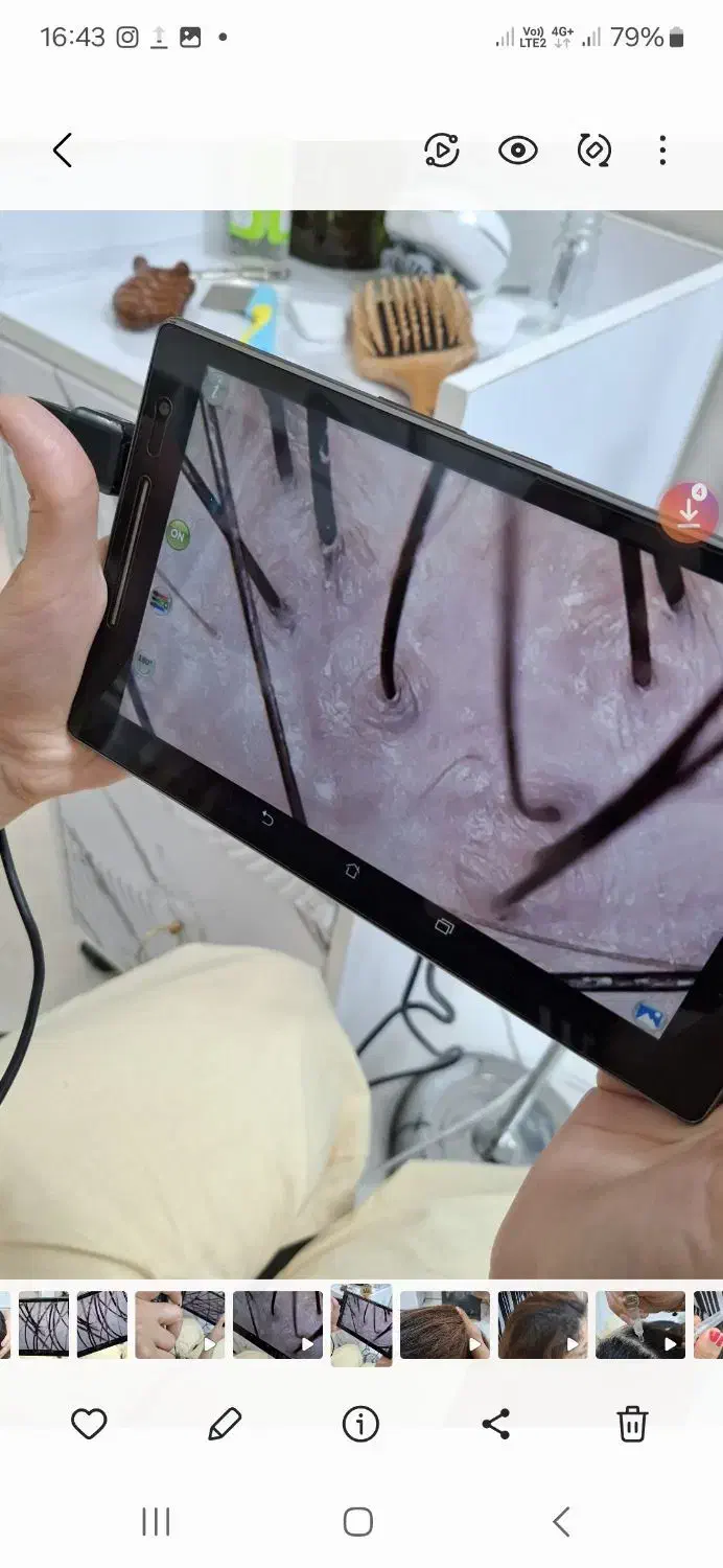 درمان قطعی موخوره و ریزش مو رایگان شد.|خدمات آرایشگری و زیبایی|رشت, کوی بیانی|دیوار