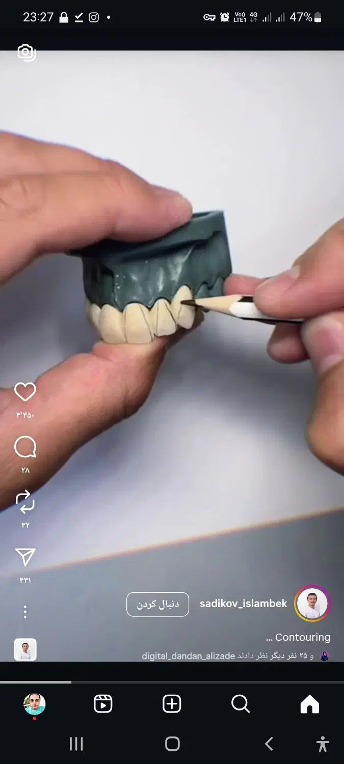 کاراموز در بخش دندان سازی|استخدام آموزشی|لنگرود, |دیوار