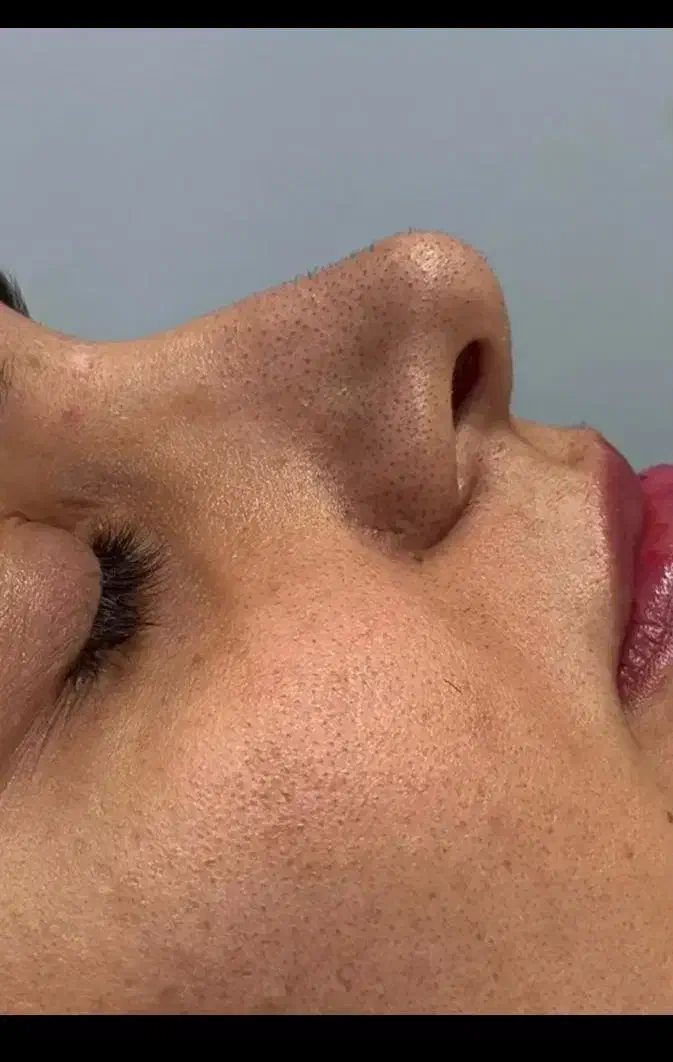 پاکسازی ۲۹۰، فیشیال ،جوانسازی صورت پوست کره ای|خدمات آرایشگری و زیبایی|علیآباد کتول, |دیوار