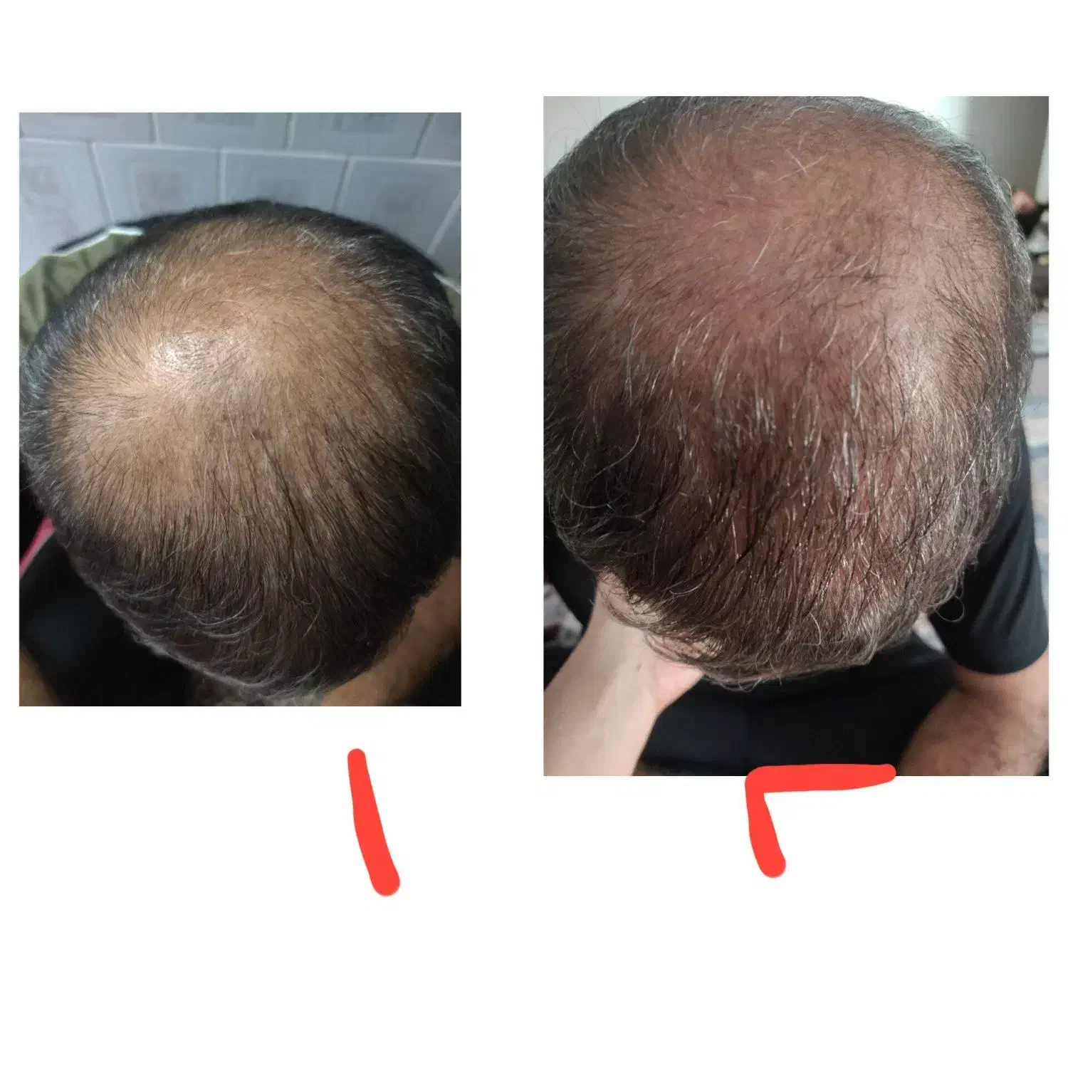 روغن تقویت و رشد مجدد مو|خوردنی و آشامیدنی|تهران, نارمک جنوبی|دیوار