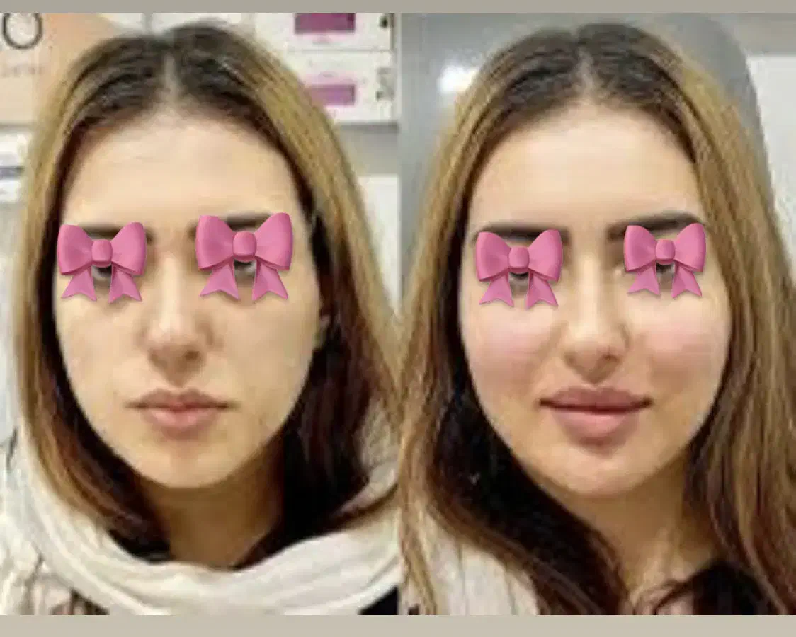 خدمات تخصصی پوست و مو در کلینیک فرسیما|خدمات آرایشگری و زیبایی|اسلام‌شهر, باغ فیض|دیوار