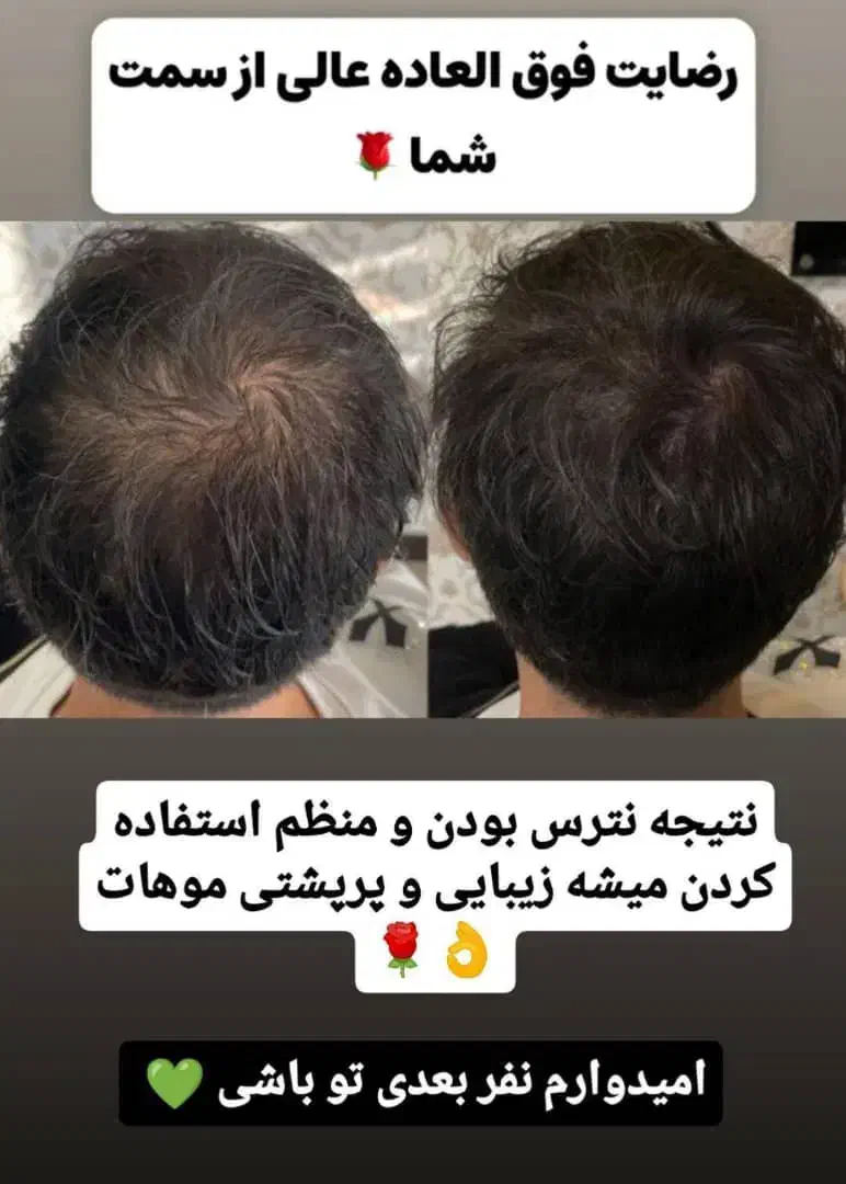 کرم ضد لک و کک و مک|آرایشی، بهداشتی، درمانی|گیلان غرب, |دیوار