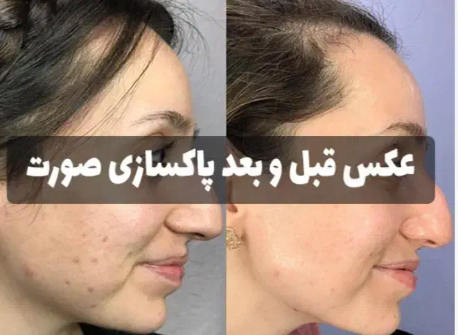 فشیال تخصص پوست|خدمات آرایشگری و زیبایی|شیراز, بعثت|دیوار