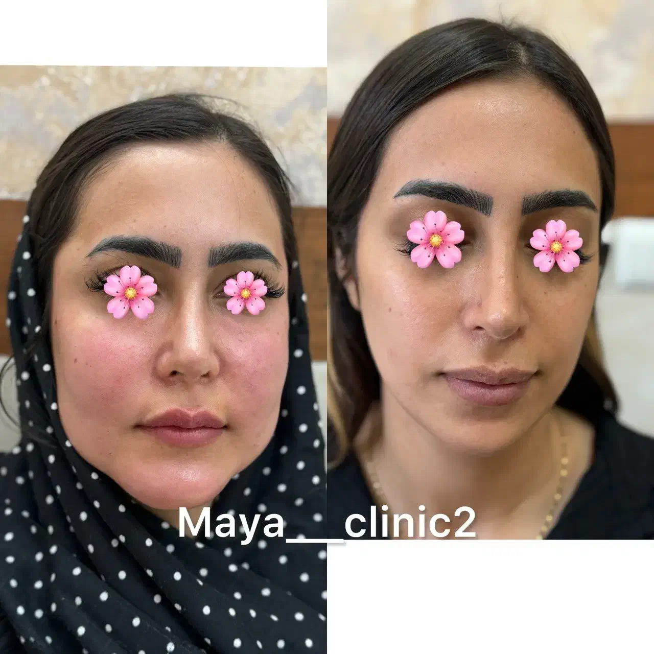 کلینیک زیبایی پوست و مو مایا|خدمات آرایشگری و زیبایی|ماهدشت, |دیوار