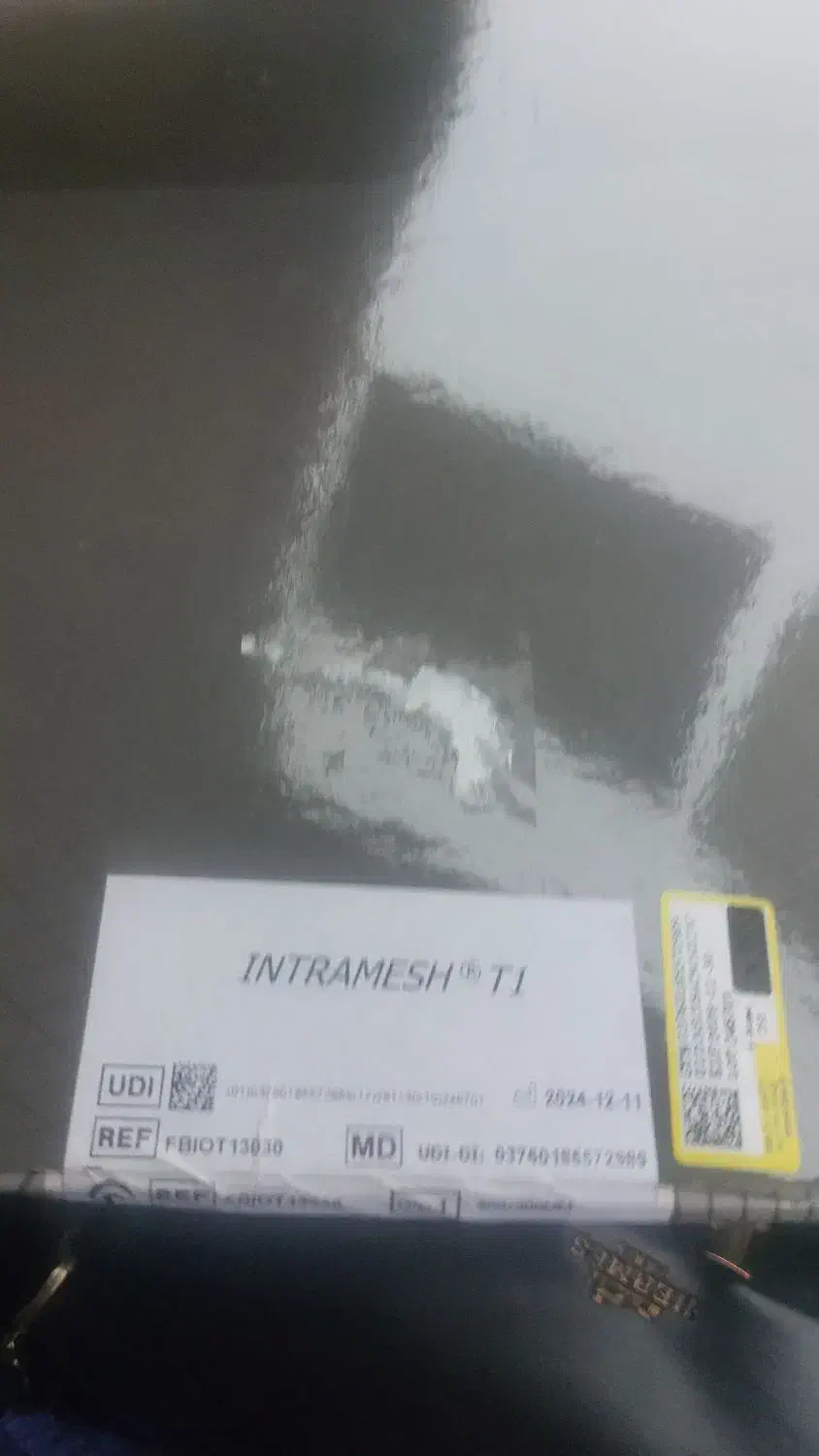 دووال مِش برای جراحی فتق|پزشکی|رودسر, |دیوار