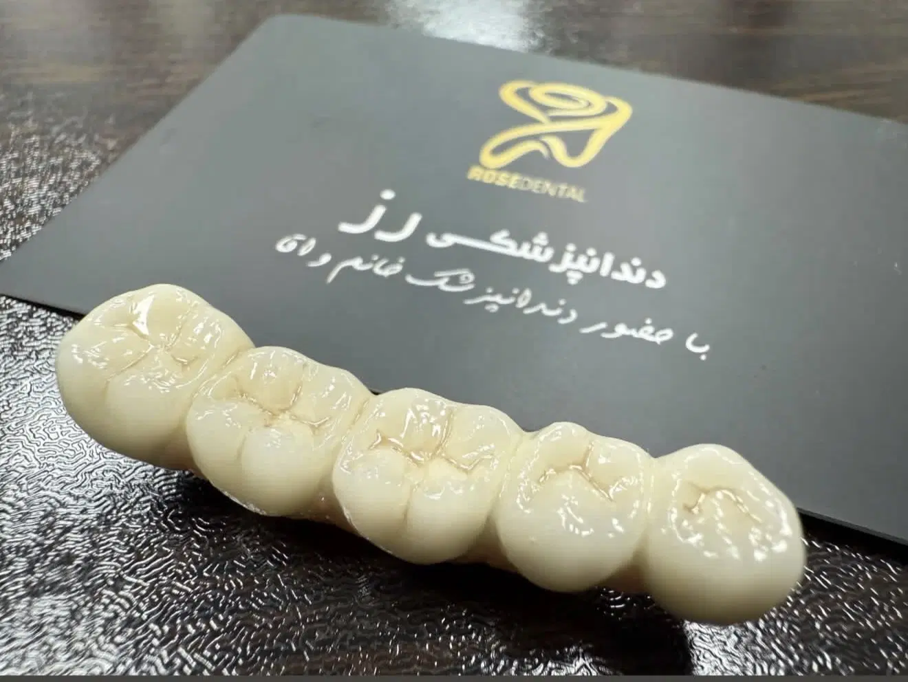 دندانپزشکی/روکش/ایمپلنت/دست دندان/کامپوزیت|خدمات زیبایی و سلامت|تهران, دولت‌آباد|دیوار