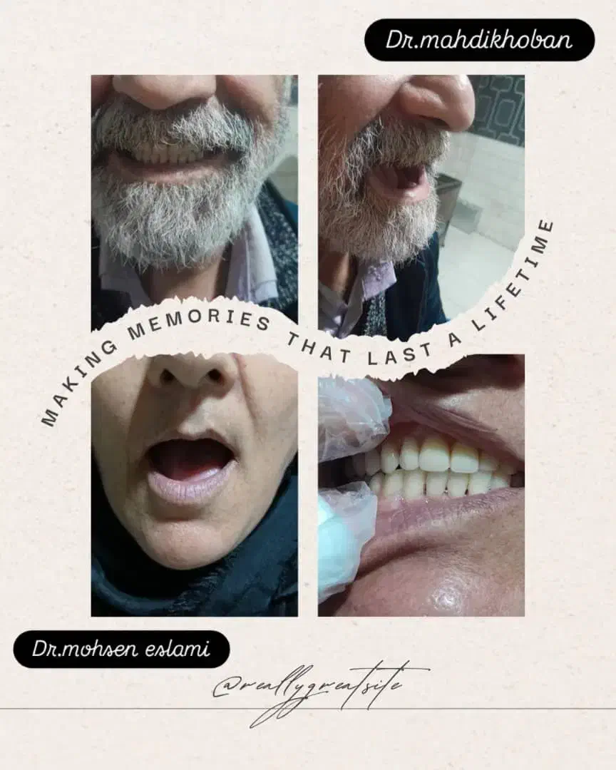 دندانپزشکی،دندانسازی|خدمات آرایشگری و زیبایی|دشتابی, |دیوار