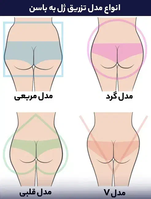 تزریق ژل باسن هیپ دیپ بیکینی آموزش فیلر بادی|خدمات آرایشگری و زیبایی|تهران, افسریه شمالی|دیوار