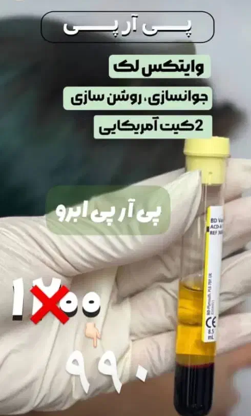 پی ارپی و مزو|خدمات آرایشگری و زیبایی|خوی, |دیوار