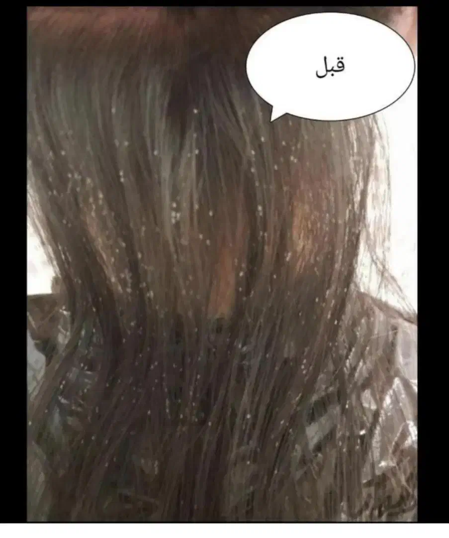 درمان قطعی رشک و شپش با ضمانت|آرایشی، بهداشتی، درمانی|سبزوار, امیر کبیر|دیوار