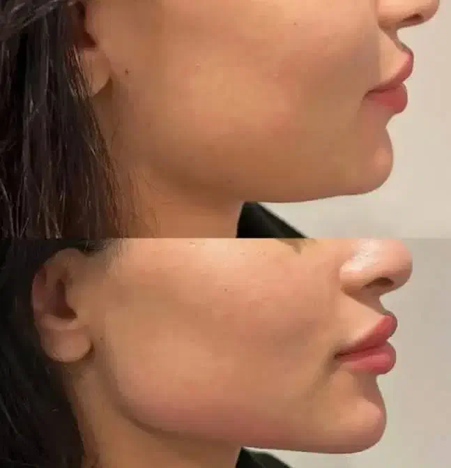 خدمات زیبایی امیدیه|خدمات آرایشگری و زیبایی|امیدیه, |دیوار