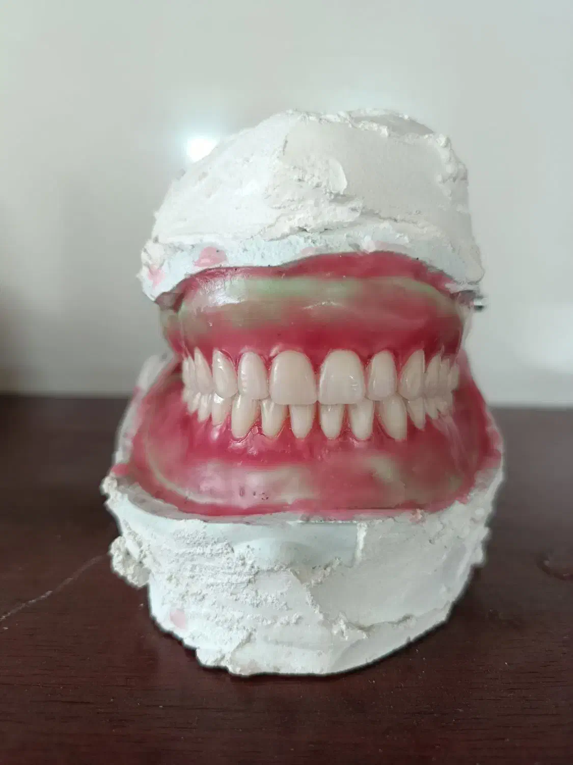 پروتز متحرک دندان|آرایشی، بهداشتی، درمانی|گنبد کاووس, |دیوار