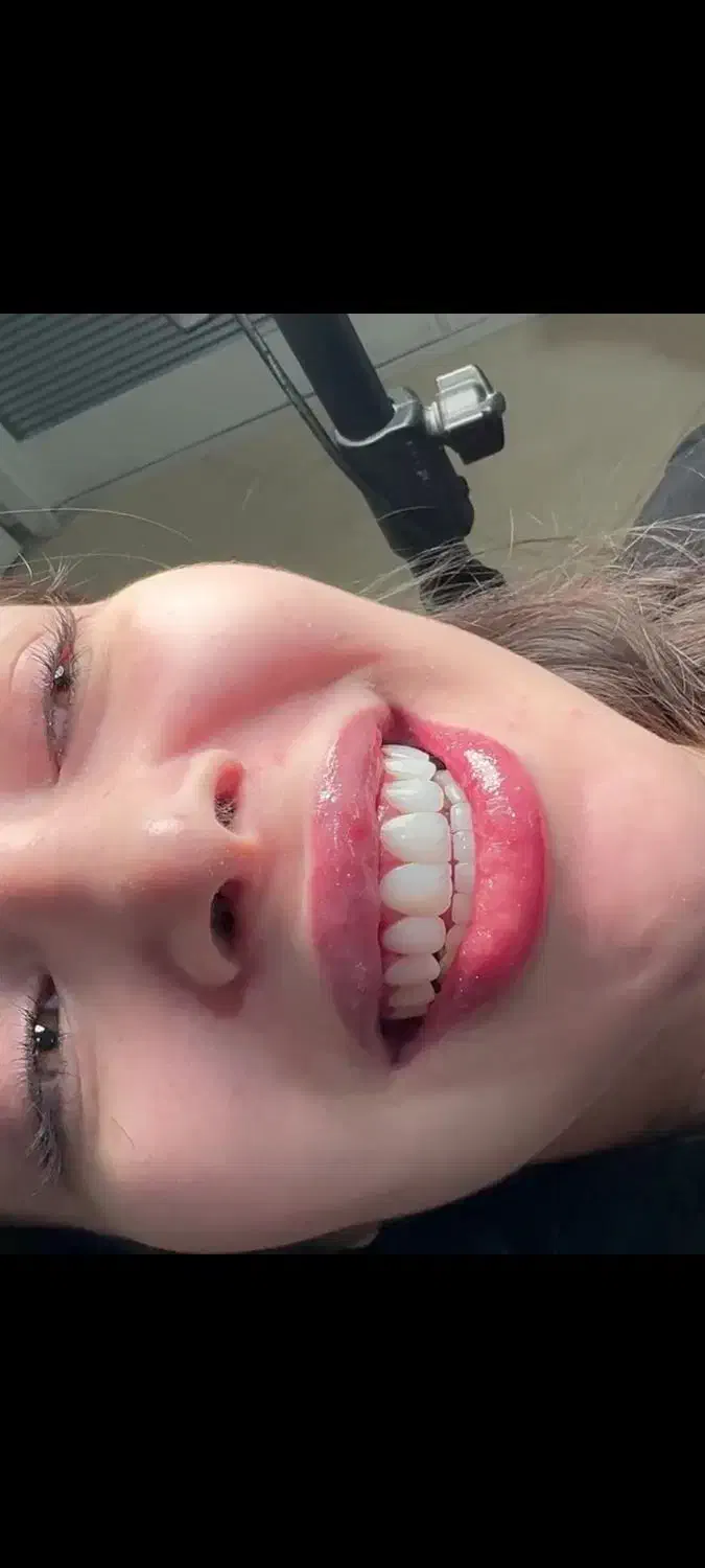 کامپوزیت دندان|خدمات آرایشگری و زیبایی|بوشهر, |دیوار