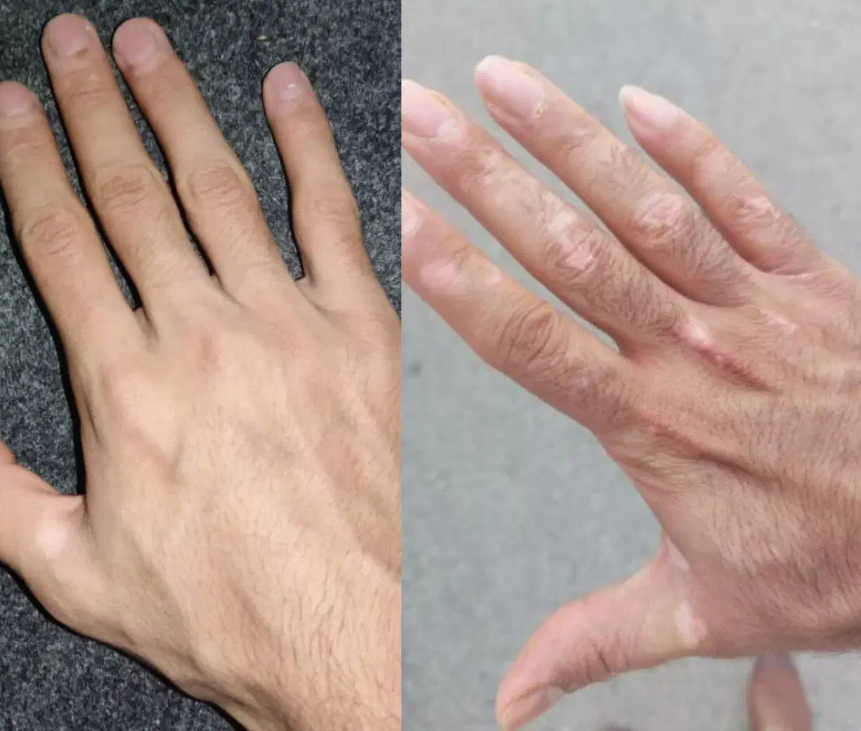 بدون برگشت و دائمی درمان بیماری پوستی|خدمات آرایشگری و زیبایی|گنبد کاووس, |دیوار