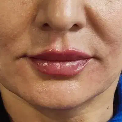 ژل لب|خدمات آرایشگری و زیبایی|مشهد, مشکینی (شهرک غرب)|دیوار