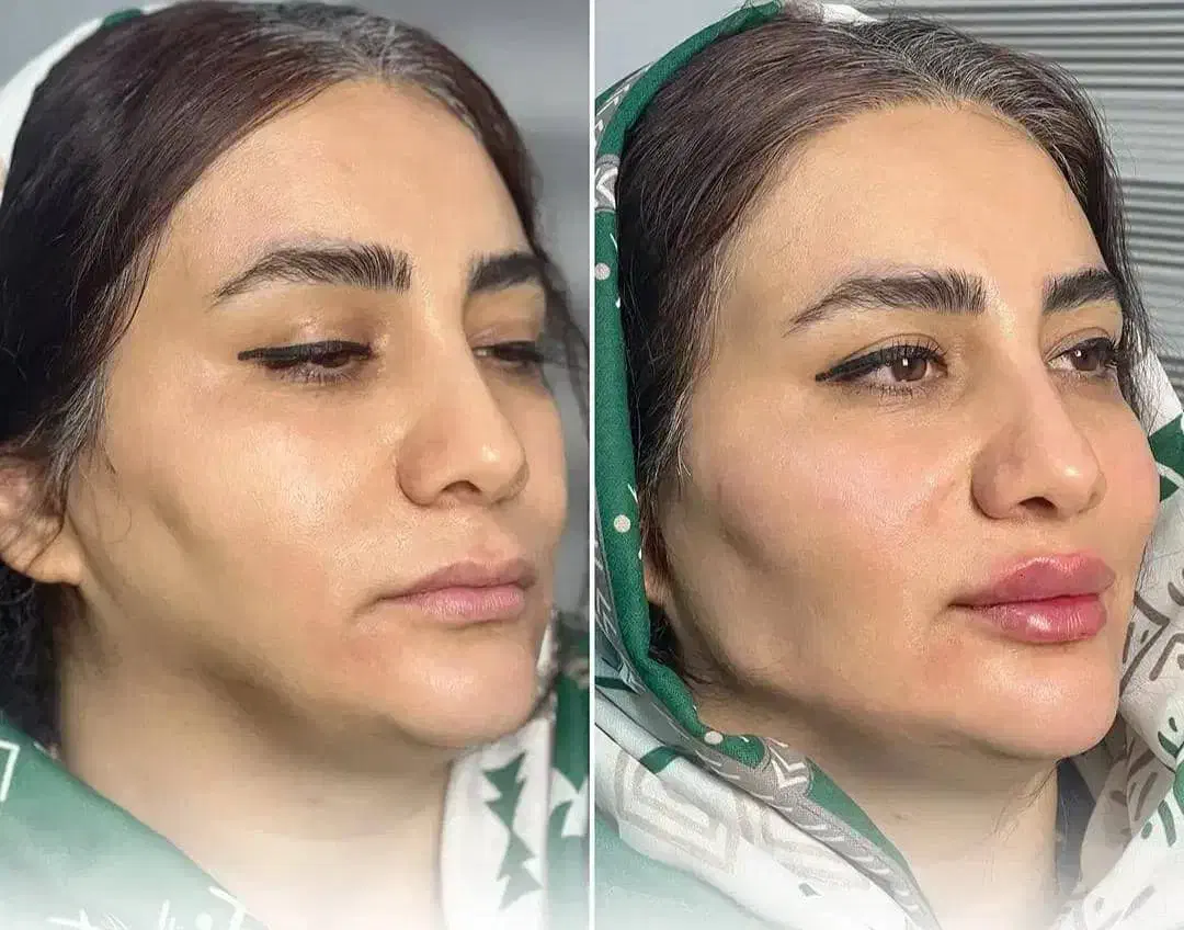 تخفیفات یلدایی ،مدل رایگان ،کلینیک دارای ۳شعبه|خدمات آرایشگری و زیبایی|شهریار, شهرک بهاران (ویره)|دیوار