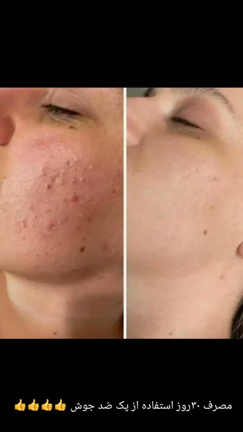 محصولات مراقبتی پوست و مو و سلامت بدن|آرایشی، بهداشتی، درمانی|خوی, |دیوار