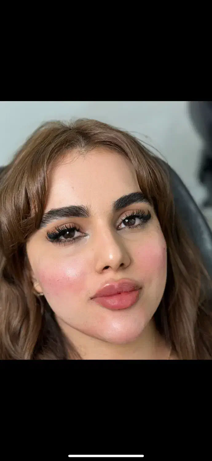 اف یلدایی ژل و بوتاکس|خدمات آرایشگری و زیبایی|اهواز, کوی ملی راه|دیوار