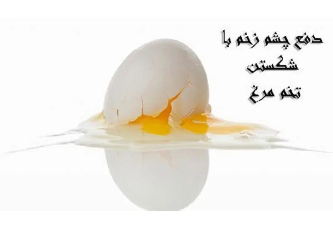 رفع چشم زخم و رفع انرژی منفی و سنگینی|خدمات پذیرایی، مراسم|زاهدان, |دیوار