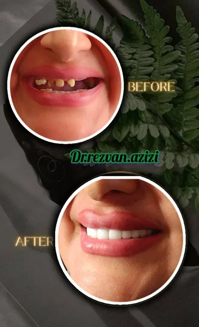 دندانپزشکی اقساطی باارائه وام و با کیفیتی استثنایی|خدمات آرایشگری و زیبایی|شیراز, ملاصدرا|دیوار